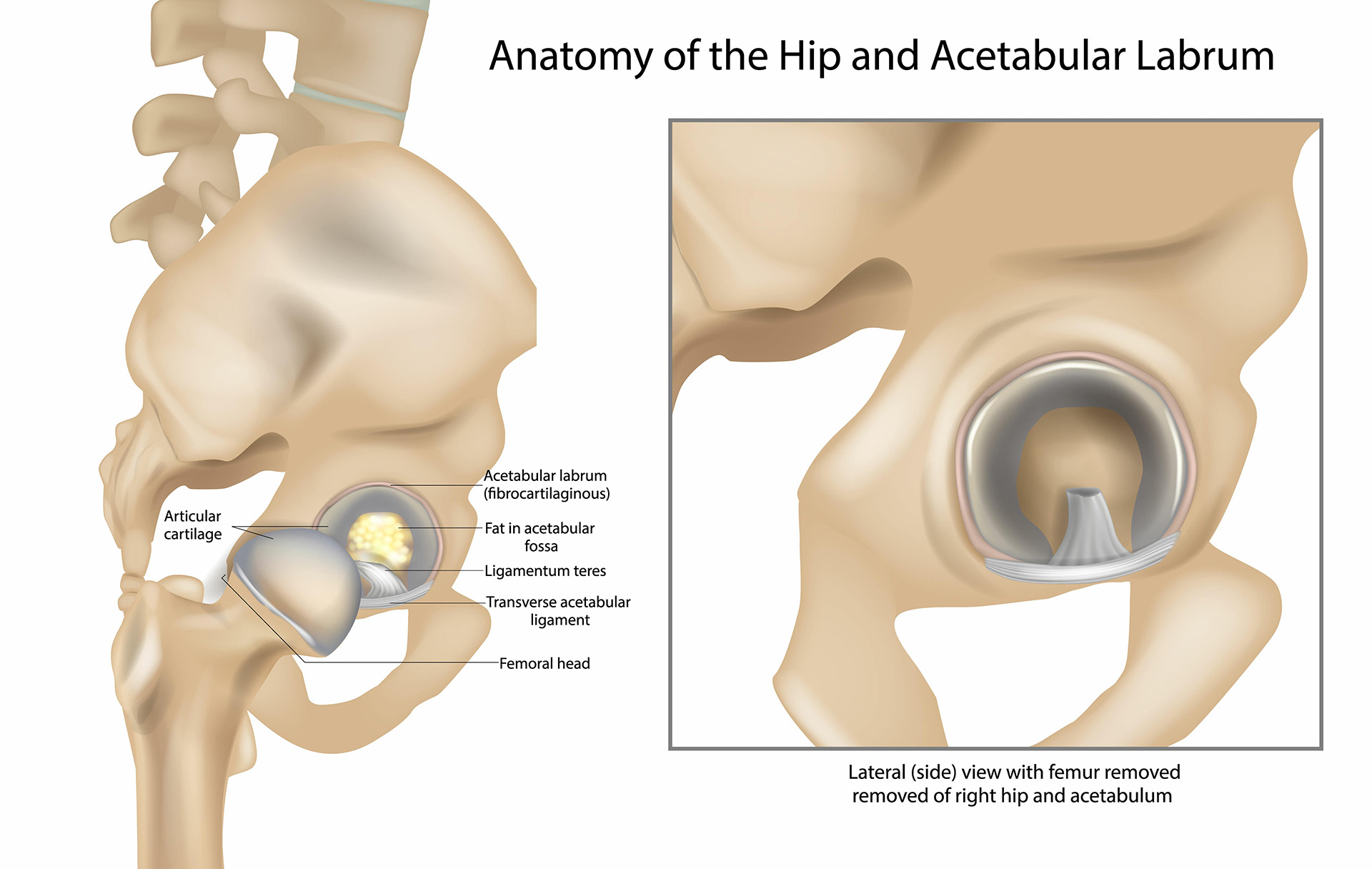 anterior hip replacement Dubai