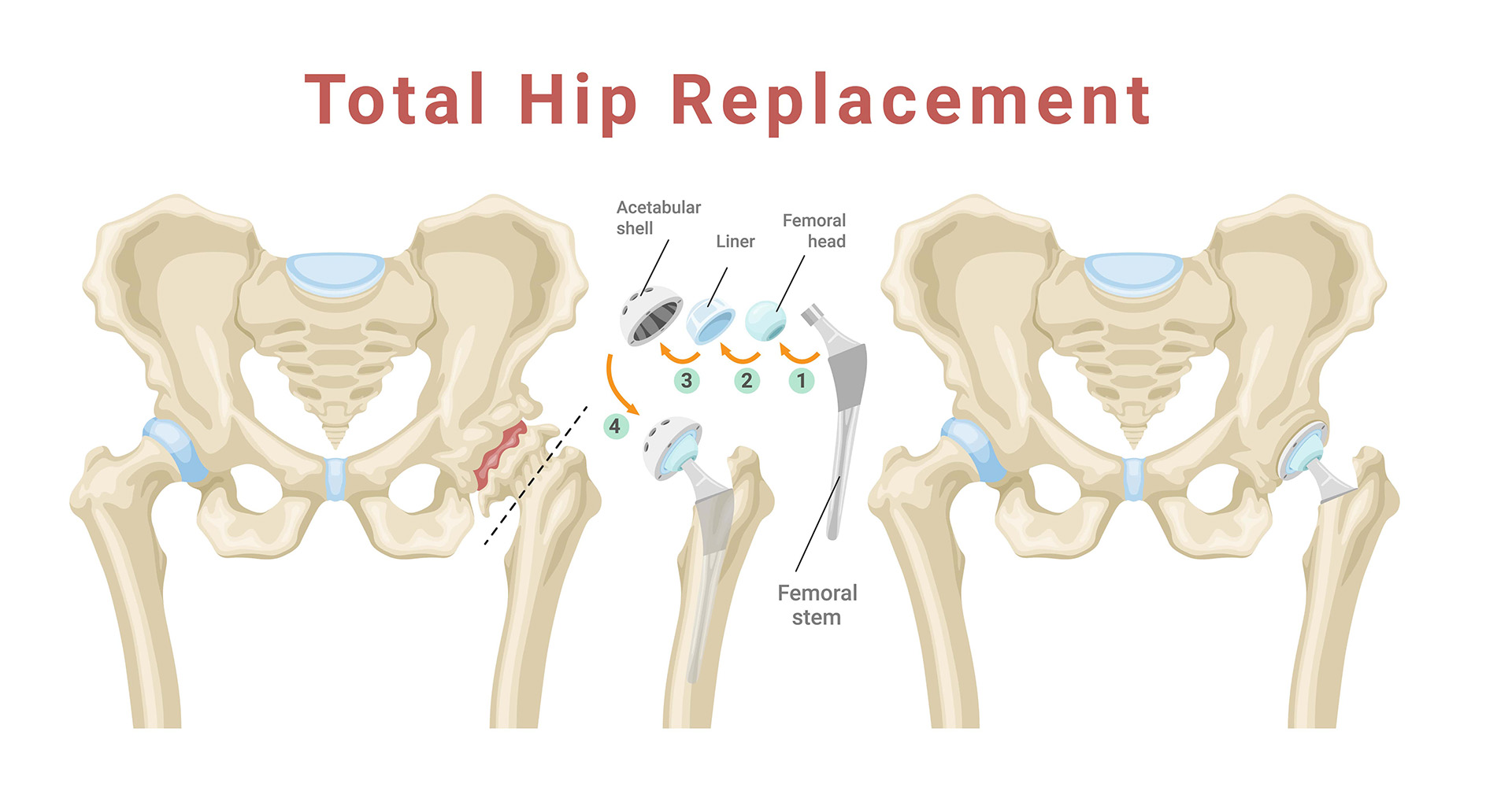 hip surgeon img1