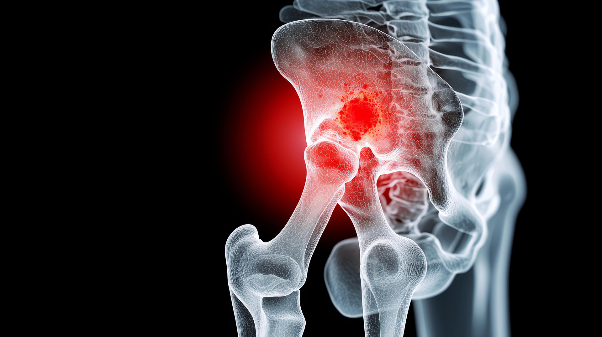 hip surgeon img3