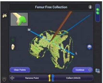 femur free collection img