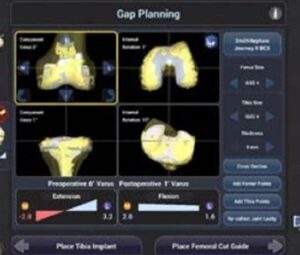 gap planning img