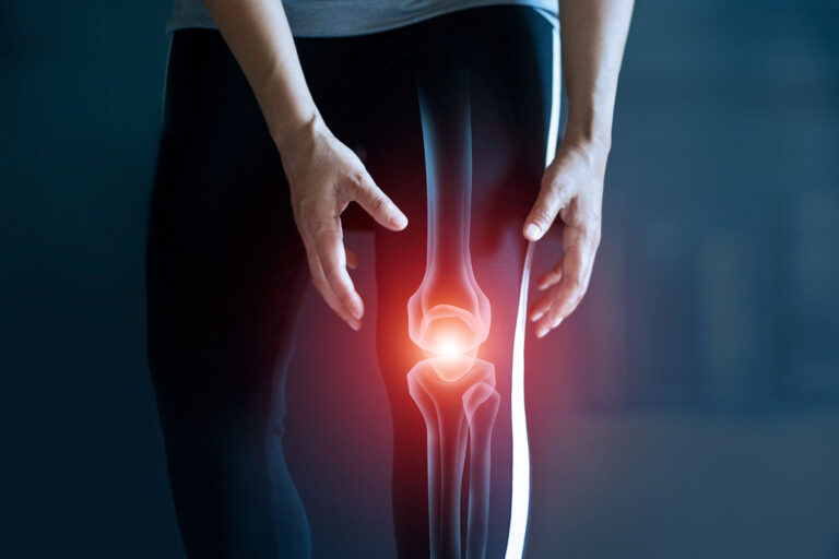 Knee Arthroscopy