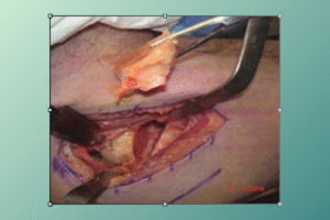 anterior hip anatomy​