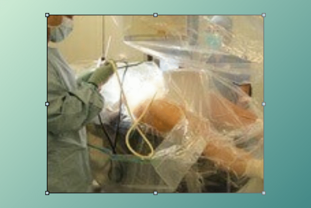 Hip Arthroscopy