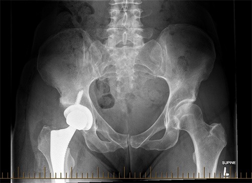adult and paediatric trauma​